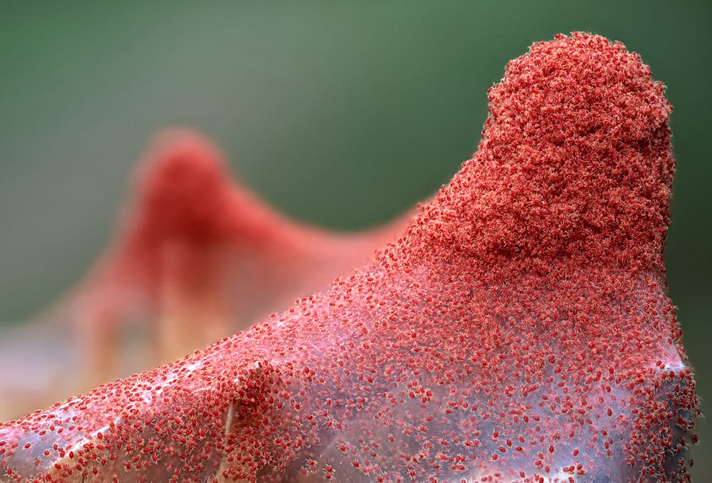 A dense colony of spider mites and their fine silk webbing, shown greatly magnified